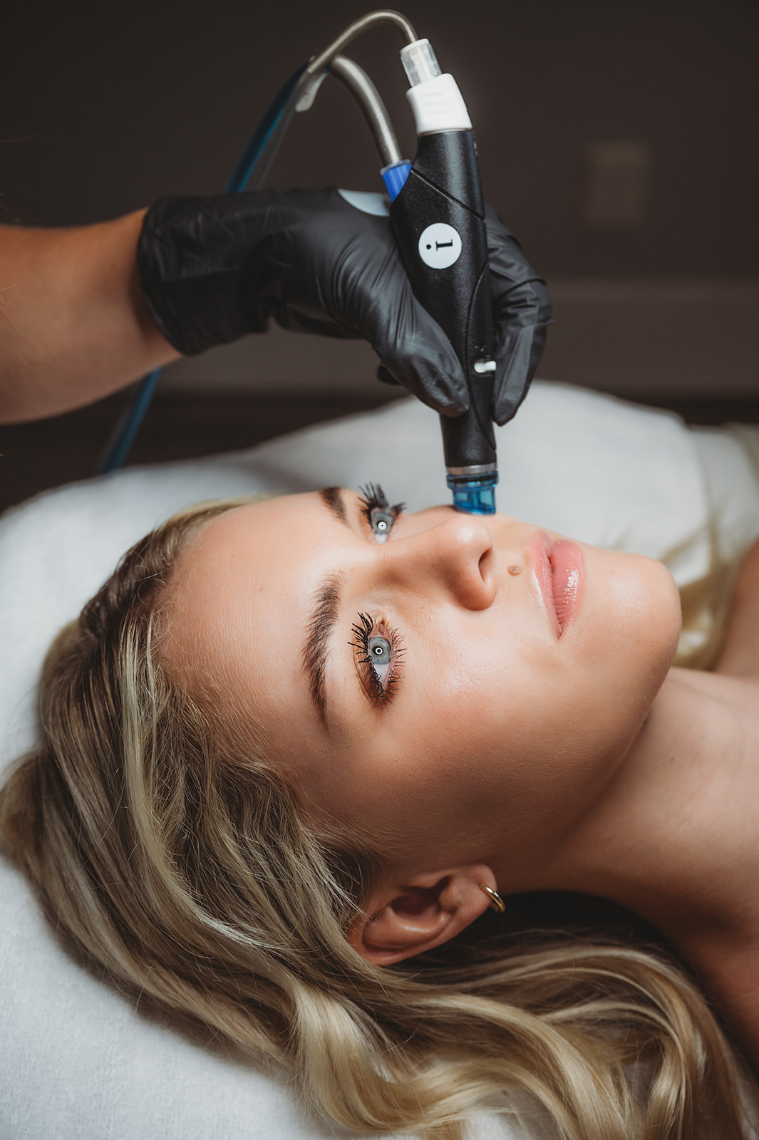 Hydrafacial in Alpine, UT | Glo Esthetics