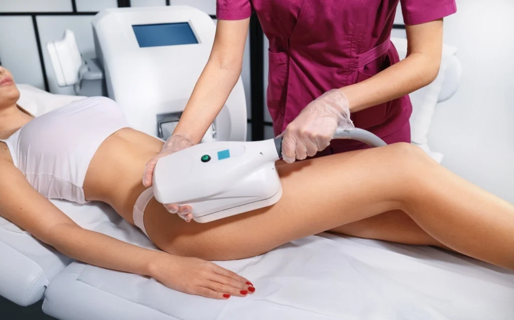 CoolSculpting