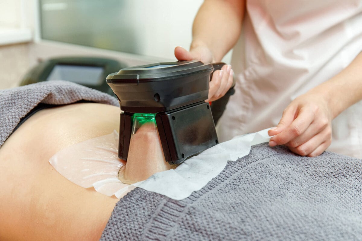 What to Expect During a CoolSculpting Session
