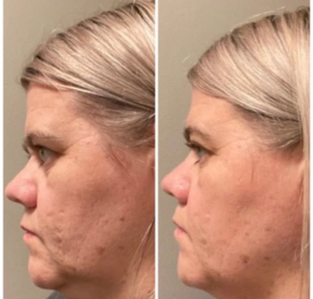 six before & after