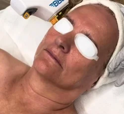 instagram-feed-alpine-ut-at-glo-esthetics