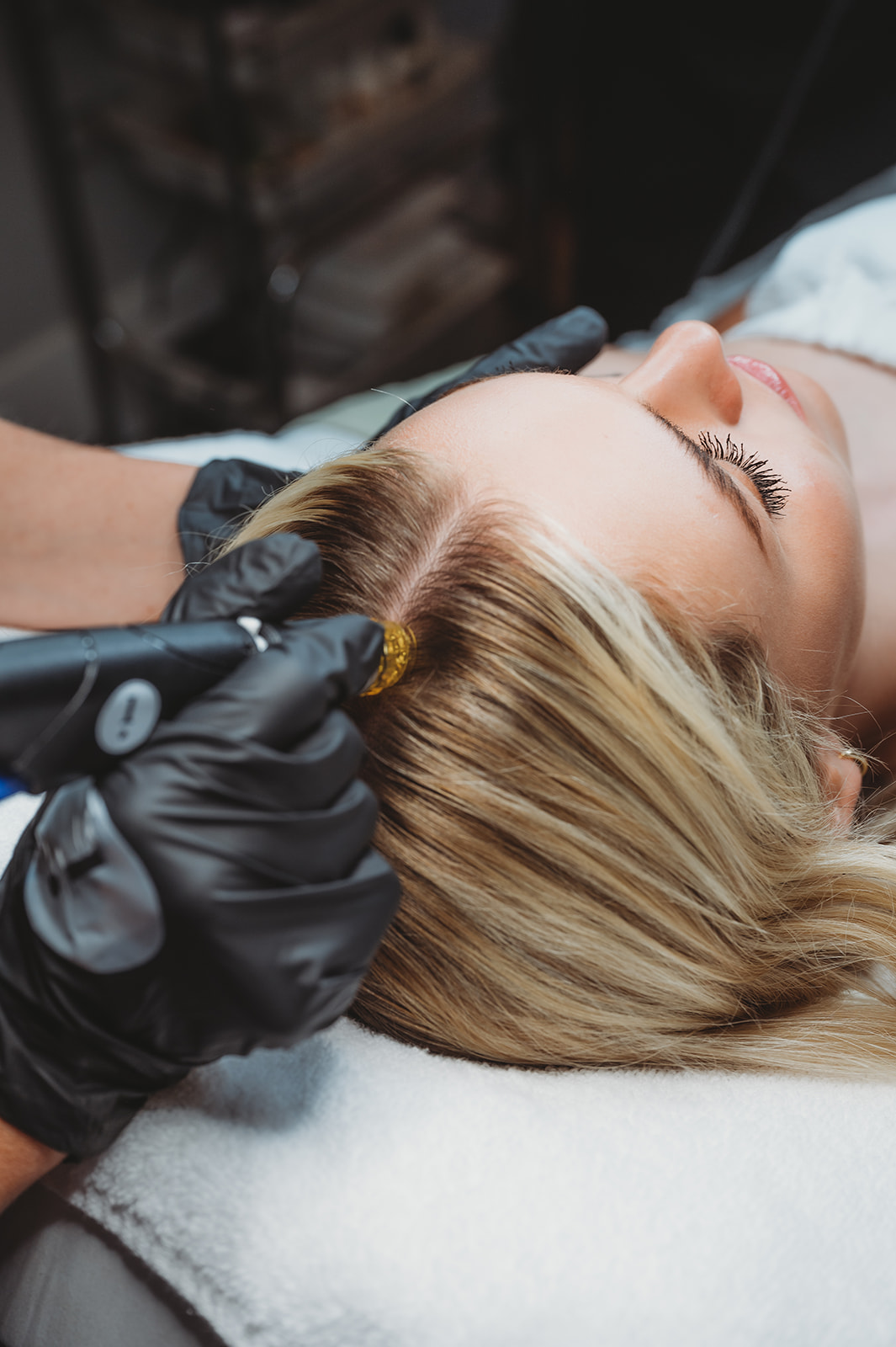 Hair Restoration Alpine, Utah Glo Esthetics